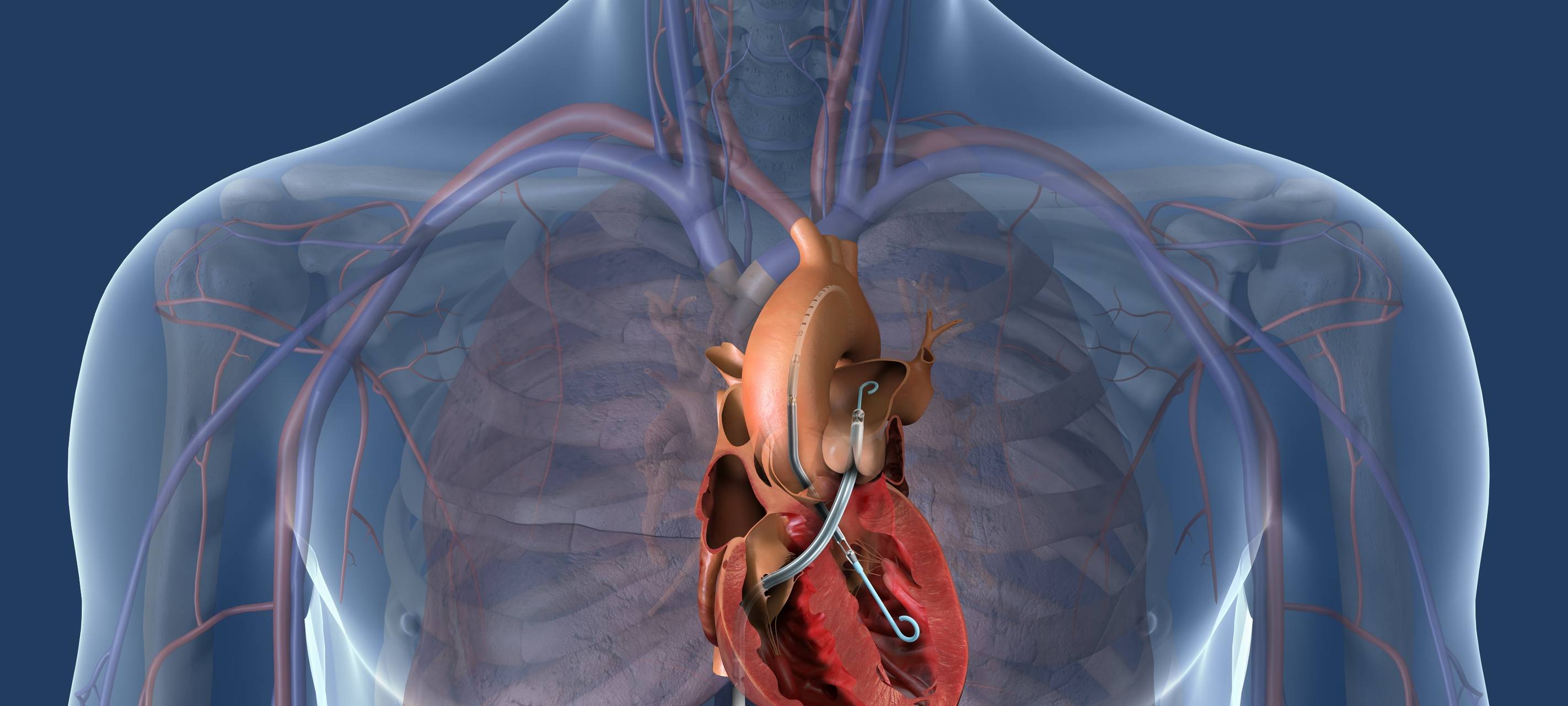 Neue Möglichkeiten für Herzpatienten am AKH