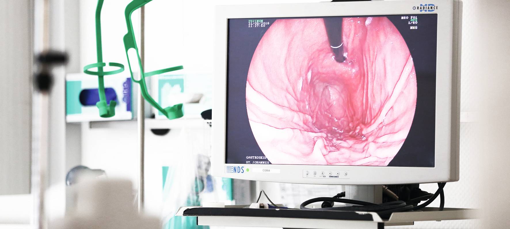 Darmkrebs: Vorsorge heilt