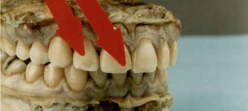 Unbekannte Tote: Zahnärzte könnten helfen